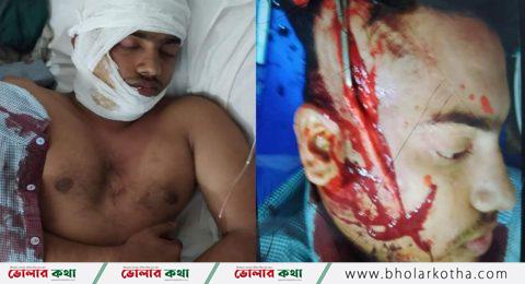 ভোলায় পূর্ব শত্রুতার জেরে ডেকে নিয়ে মাথায় কুপিয়ে জখম