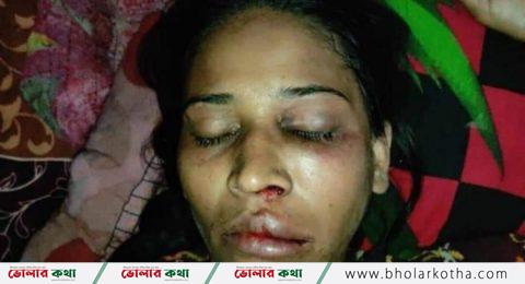 ভোলায় পরকীয়ায় বাঁধা দেয়ায় স্ত্রীকে হত্যার চেষ্টা