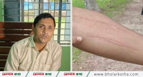 ভোলায় কলেজ পড়ুয়া ছাত্র ও বাবাকে পেটালেন অধ্যক্ষ