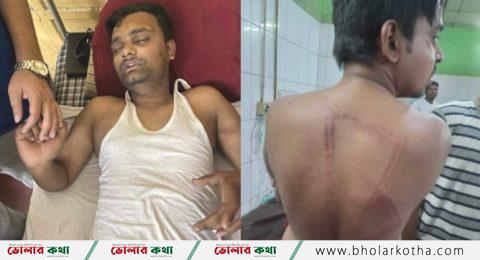 আ. লীগ-বিএনপি নেতারা দুই সাংবাদিককে পেটালেন, সিন্ডিকেটের প্রতিবাদ করায়