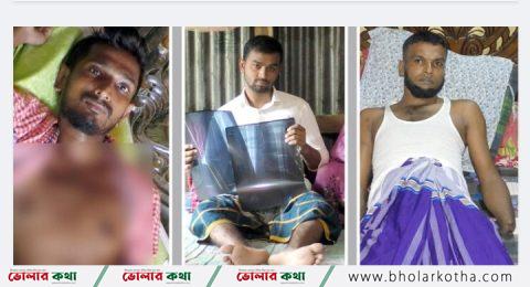 ছাত্র-জনতার আন্দোলনে গুলিবিদ্ধ ভোলার ৩ যুবক পারবে কি স্বাভাবিক জীবনে ফিরতে?