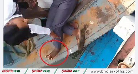 লঞ্চের ধাক্কায় যাত্রীর পা থেকে তালু বিচ্ছিন্ন