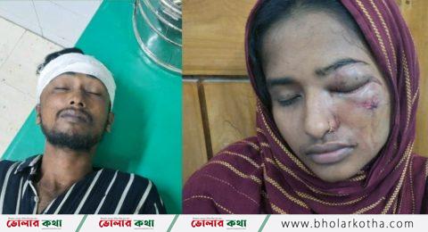 তজুমদ্দিনে ইউনিয়ন বিএনপি’র সভাপতির নেতৃত্বে যুবদল কর্মীর উপর হামলার অভিযোগ, আহত-২