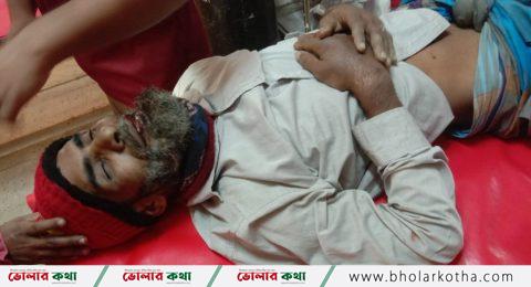 তজুমদ্দিনে রাতভর নির্যাতন, রগ কেটে অটোরিকশা চালককে হত্যার অভিযোগ